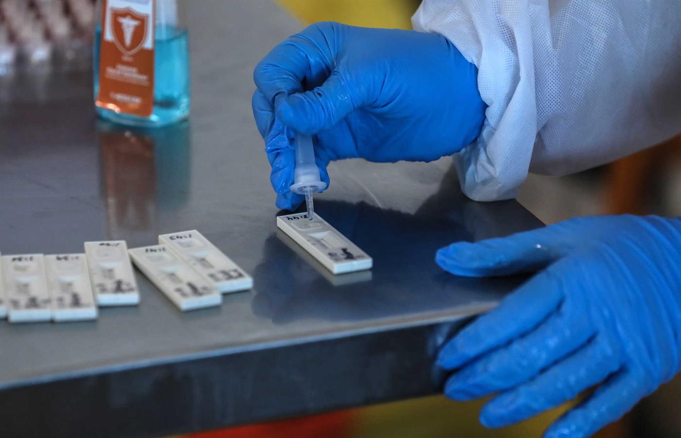 homem com luvas cirúrgicas azuis faz testes rápidos de covid