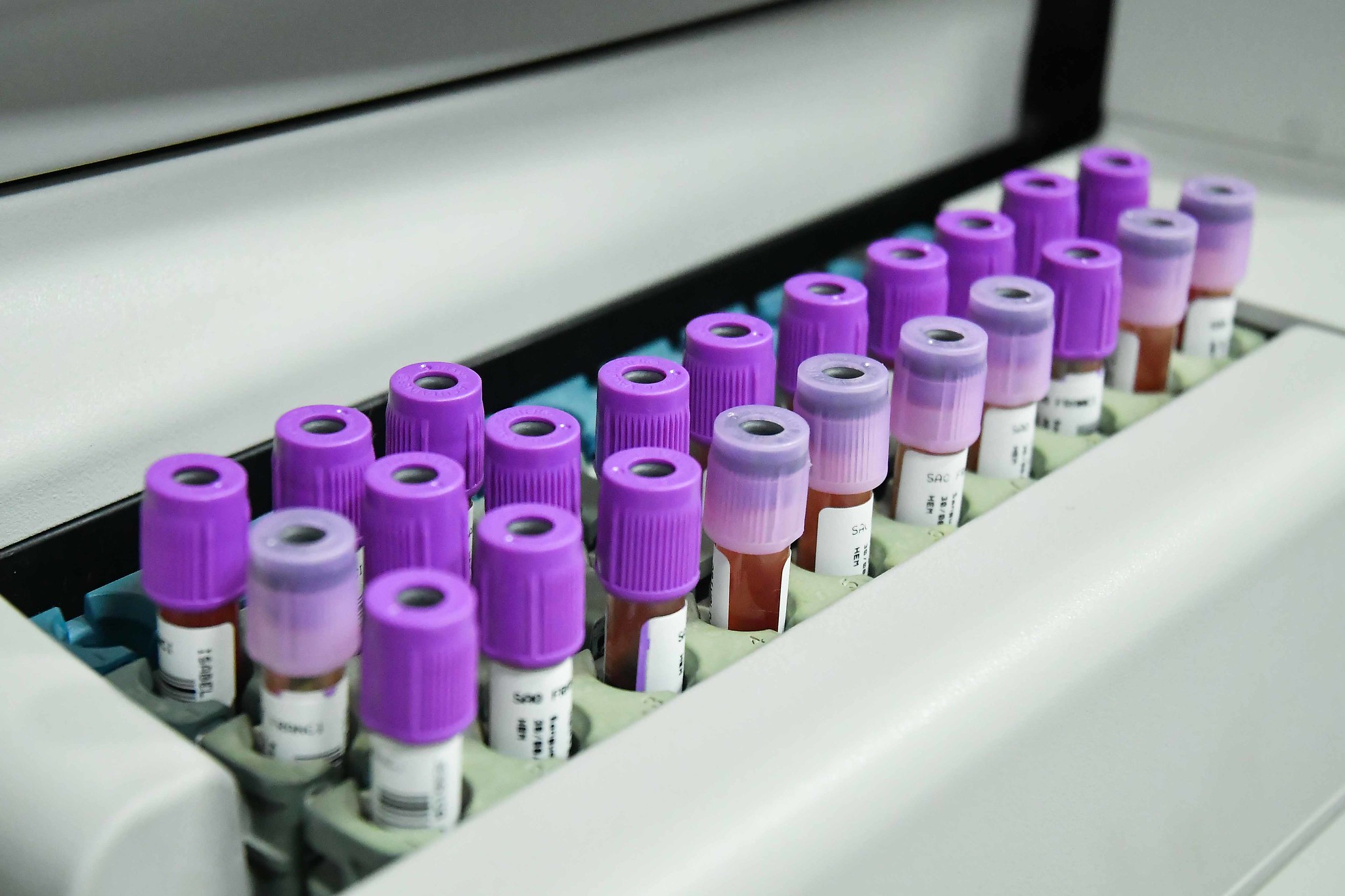 Foto da matéria Sem óbitos e sem pessoas internadas, Boletim Covid informa 27 novos casos