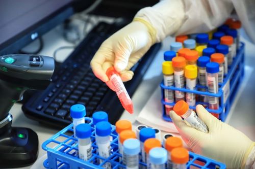 Foto da matéria Novos casos de covid confirmados no final de semana são 35